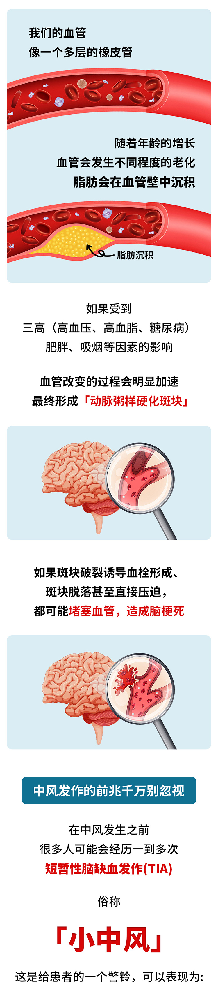 中風的5個前兆，盡早發(fā)現(xiàn)能救命_02.jpg